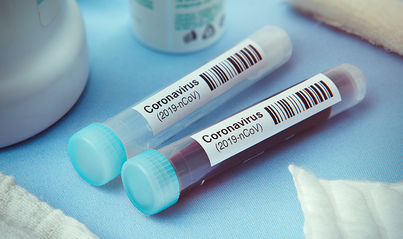 blood test vials marked coronavirus